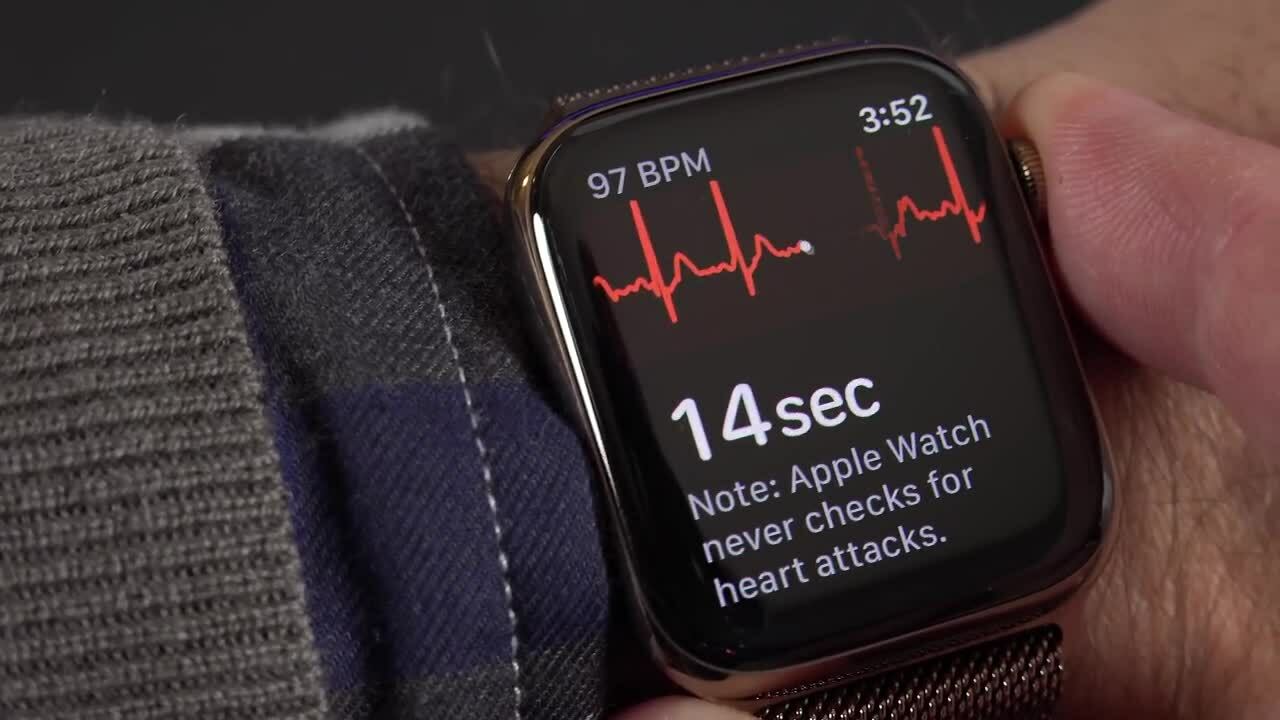 Ứng Dụng ECG Trên Apple Watch Series 6 Chính Thức Ra Mắt Tại Việt Nam ...